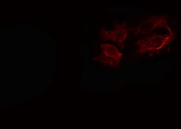 GANAB / Alpha Glucosidase II Antibody
