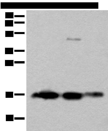 Polyclonal Rabbit anti-Human SNCB / Beta-Synuclein Antibody (IHC, WB)