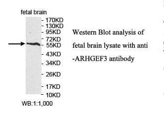 Polyclonal Rabbit anti-Human ARHGEF3 / XPLN Antibody (aa3-194, IHC, WB)