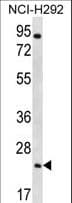 AQP5 / Aquaporin 5 Antibody (aa227-256)