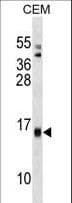 SAA4 Antibody (aa97-124)
