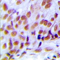 HNRNPC / HNRNP C Antibody (C-Terminus)