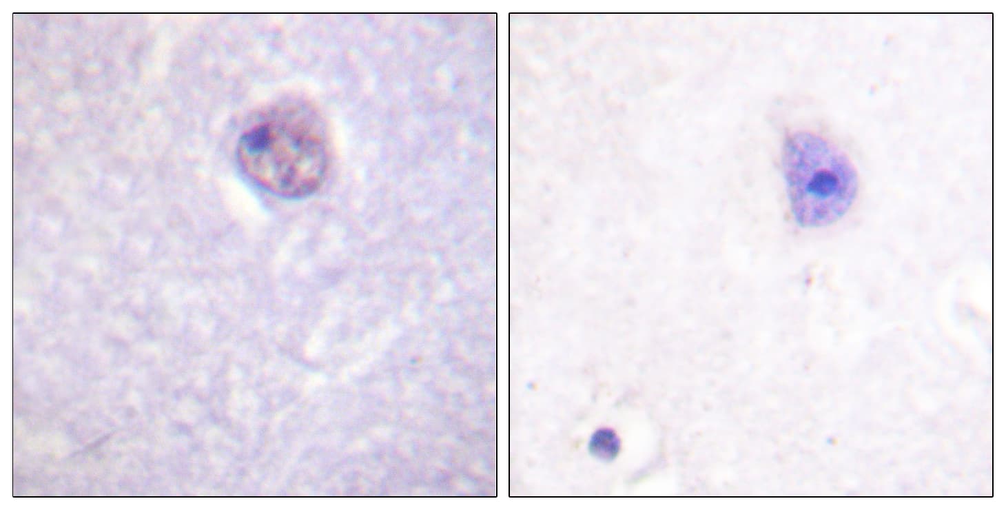 SOX9 Antibody (phospho-Ser181)