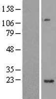 C1orf109 Protein (Over-Expression Lysate Myc-DDK (Flag))