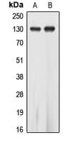 EPHA5 / EPH Receptor A5 Antibody (Internal)