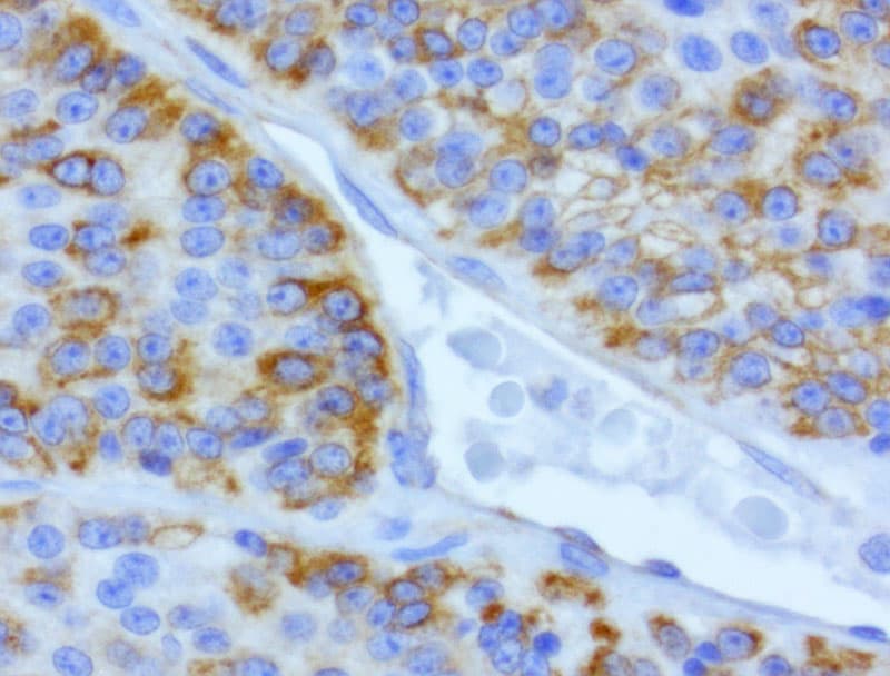 CDH2 / N Cadherin Antibody (clone UMAB23, Carrier-free)