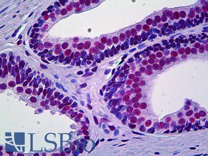 IHC-plus™ Monoclonal Mouse anti-Human PRKDC / DNA-PKcs Antibody (clone 1B9, IHC, WB)