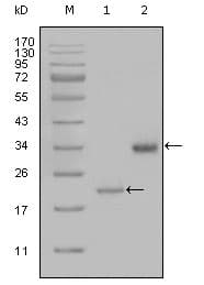 IHC-plus™ Monoclonal Mouse anti-Human LPA / Lipoprotein a Antibody (clone 8F6A9, IHC, WB)