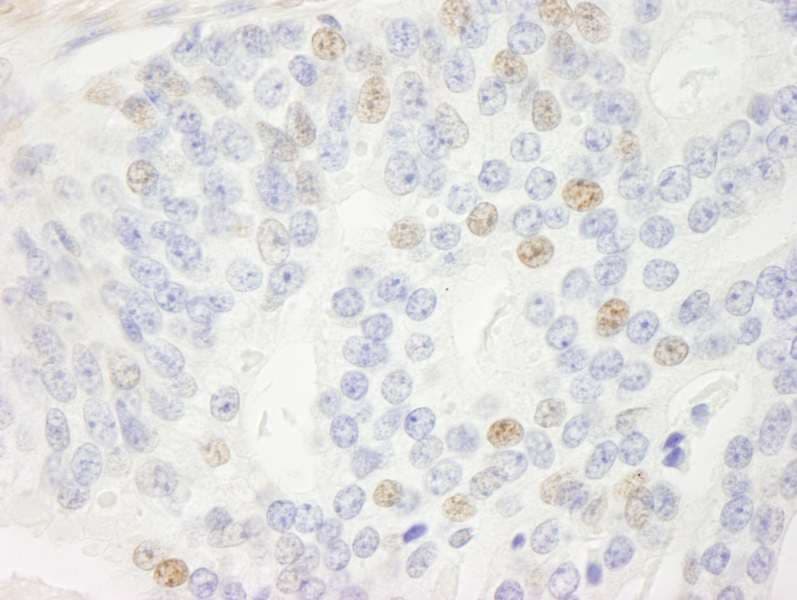 p14ARF / CDKN2A Antibody (aa125-C-term)