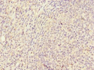 CD320 Antibody