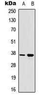 RAD51 / RECA Antibody (C-Terminus)