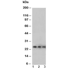 VEGFA / VEGF Antibody (aa59-74)