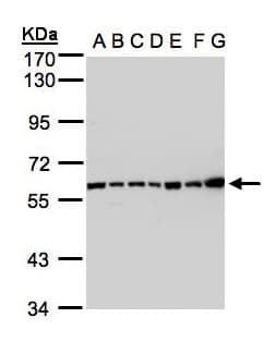 Complement C2 Antibody (aa265-642)