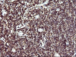 PathPlus™ IL10RA Antibody (clone 1D10)