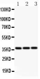BMI1 / PCGF4 Antibody (aa135-165)