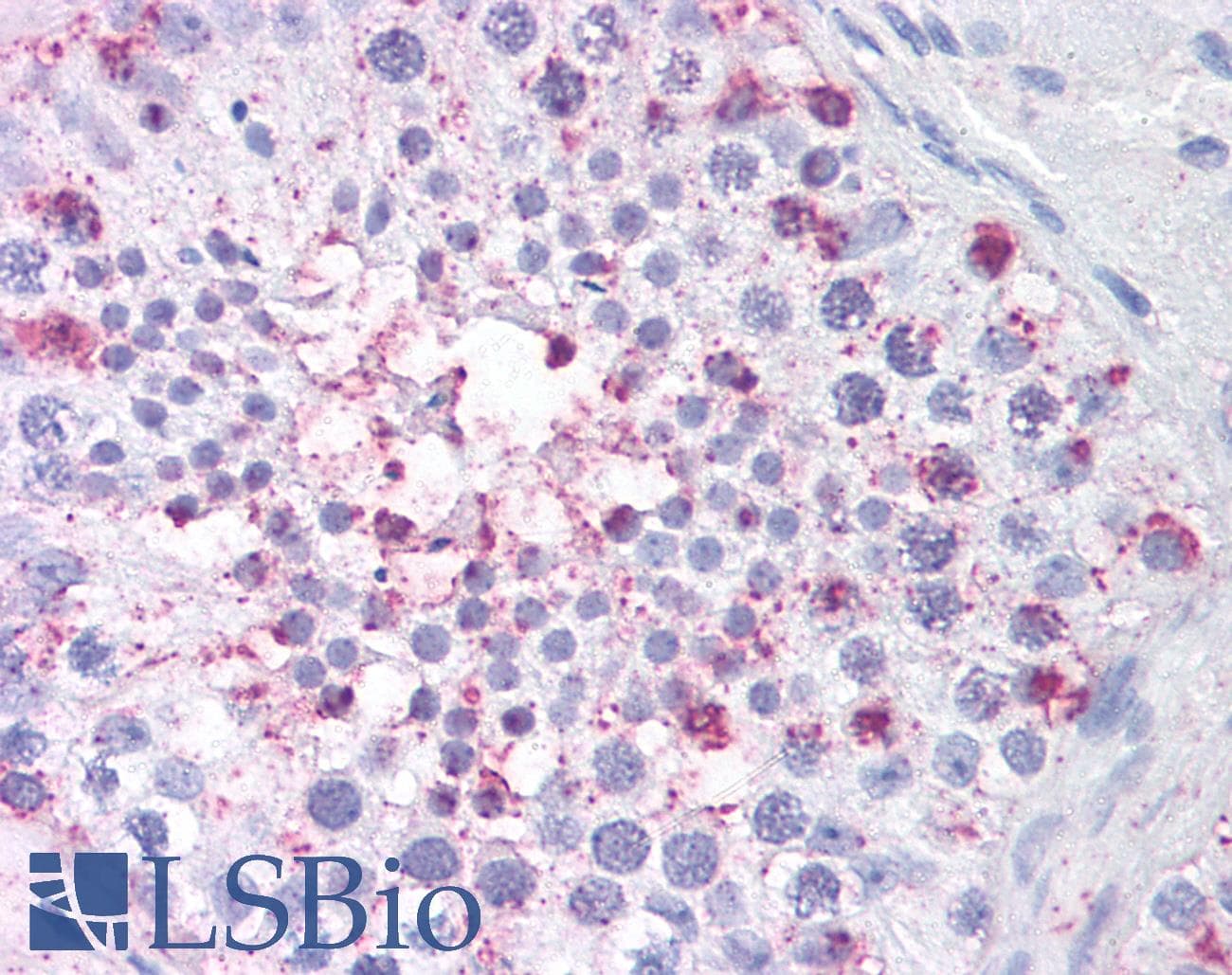 IHC-plus™ USP2 Antibody (Internal)
