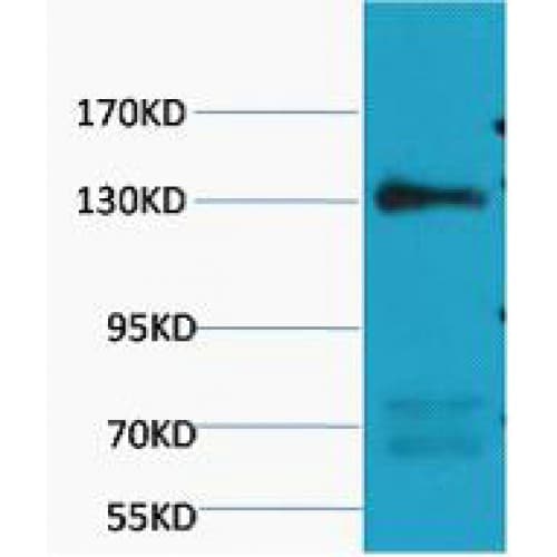 Monoclonal Mouse anti-Human NOS3 / eNOS Antibody (clone Mix, WB)