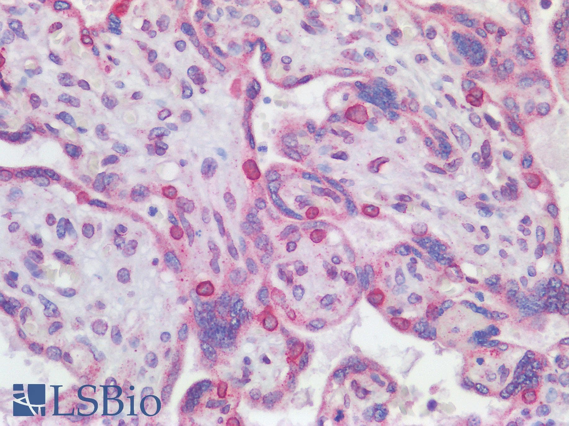 IHC-plus™ Polyclonal Rabbit anti-Human RANGAP1 Antibody (aa400-450, IHC)