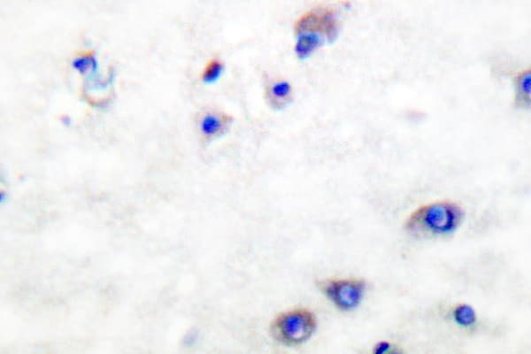 BACE1 / BACE Antibody (Asp492)