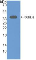 NT5C3A Antibody (PE)