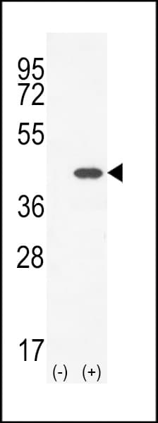 SCGF Antibody (aa145-174)