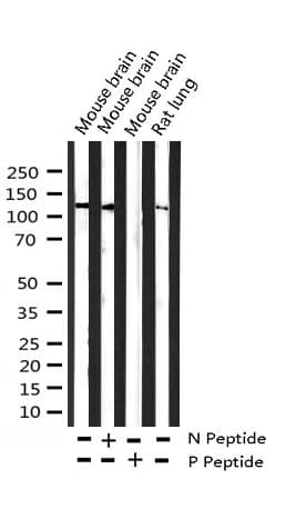 Polyclonal Rabbit anti-Human FGFR1 / FGF Receptor 1 Antibody (phospho-Tyr654, IF, WB)