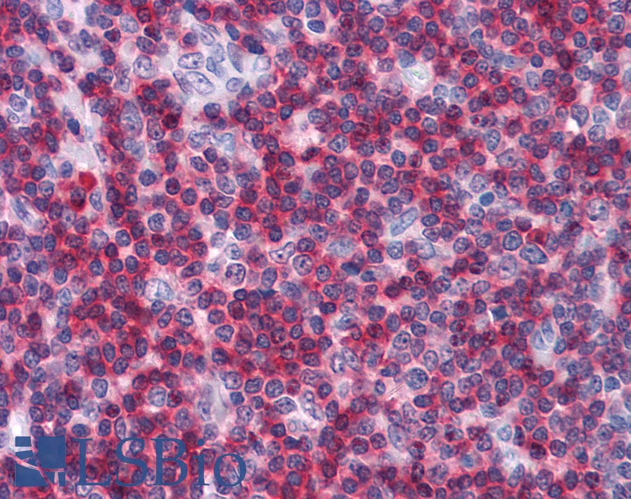 IHC-plus™ Monoclonal Mouse anti-Human CD247 / CD3 Zeta Antibody (clone 4B10, aa52-164, IHC, IF, WB)
