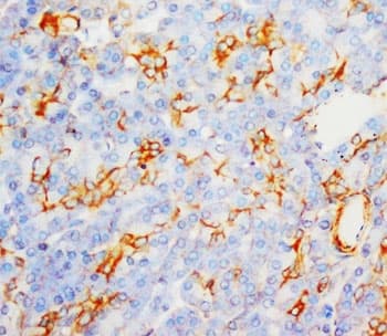 MPO / Myeloperoxidase Antibody (aa714-728)
