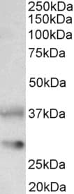 CLU / Clusterin Antibody (aa435-448)