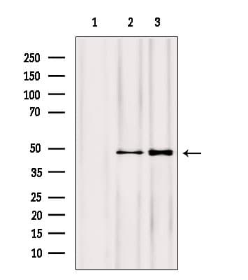 Polyclonal Rabbit anti-Human NOB1 / NOB1P Antibody (IHC, WB)