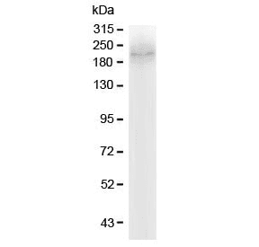 Polyclonal Rabbit anti-Human ABCC2 / MRP2 Antibody (IHC, WB)