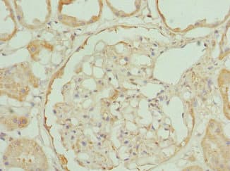 RP2 Antibody