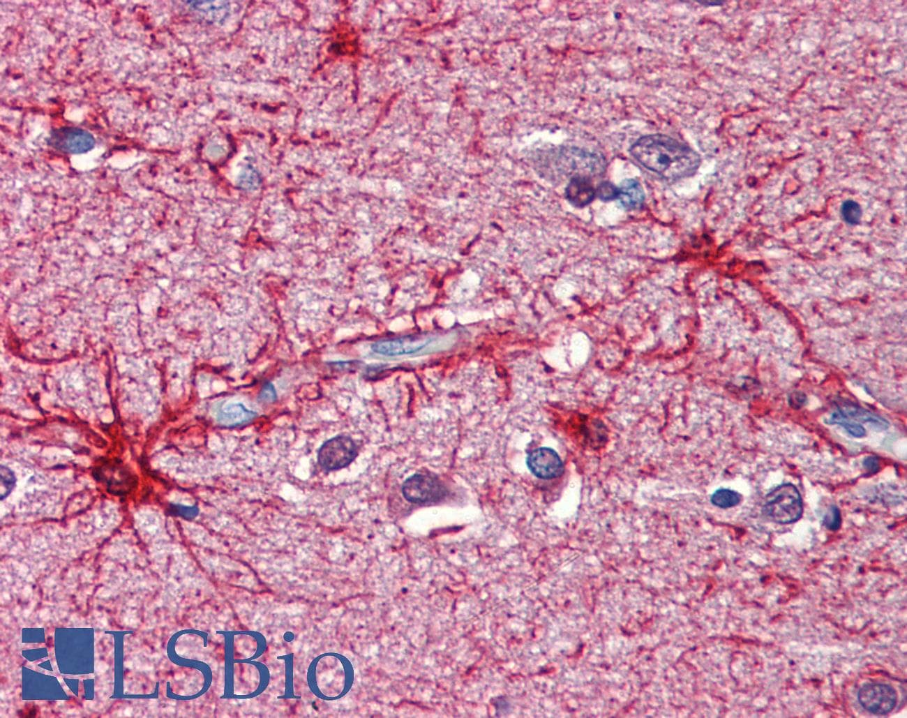 IHC-plus™ NIPSNAP3B Antibody