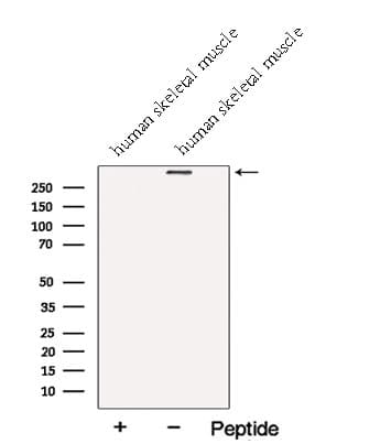 Polyclonal Rabbit anti-Human NEB / Nebulin Antibody (WB)
