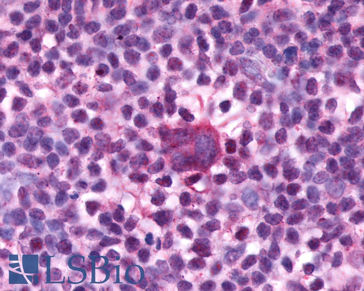 IHC-plus™ ADGRE1 / EMR1 Antibody (N-Terminus)