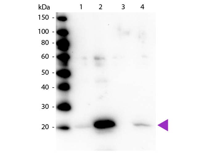 Polyclonal Rabbit anti-Human MYL12A / MRCL3 Antibody (phospho-Ser19/20, IHC, WB)