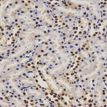 PELP1 Antibody