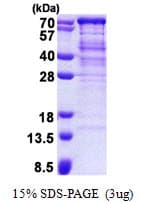 Human UBXD9 / ASPL Protein (Recombinant His)