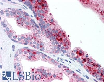 IHC-plus™ ROBO2 Antibody