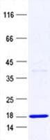 Human C17orf98 Protein (Recombinant His, N-Terminal)