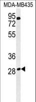 Polyclonal Rabbit anti-Human RRAGD Antibody (aa171-199, IHC, WB)