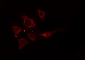 SLC27A5 / BACS Antibody