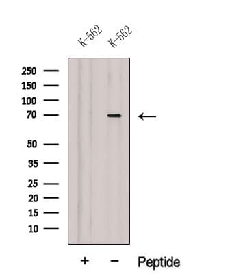 Polyclonal Rabbit anti-Human DARS2 Antibody (IF, WB)