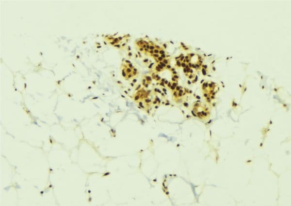 KLK6 / Kallikrein 6 Antibody