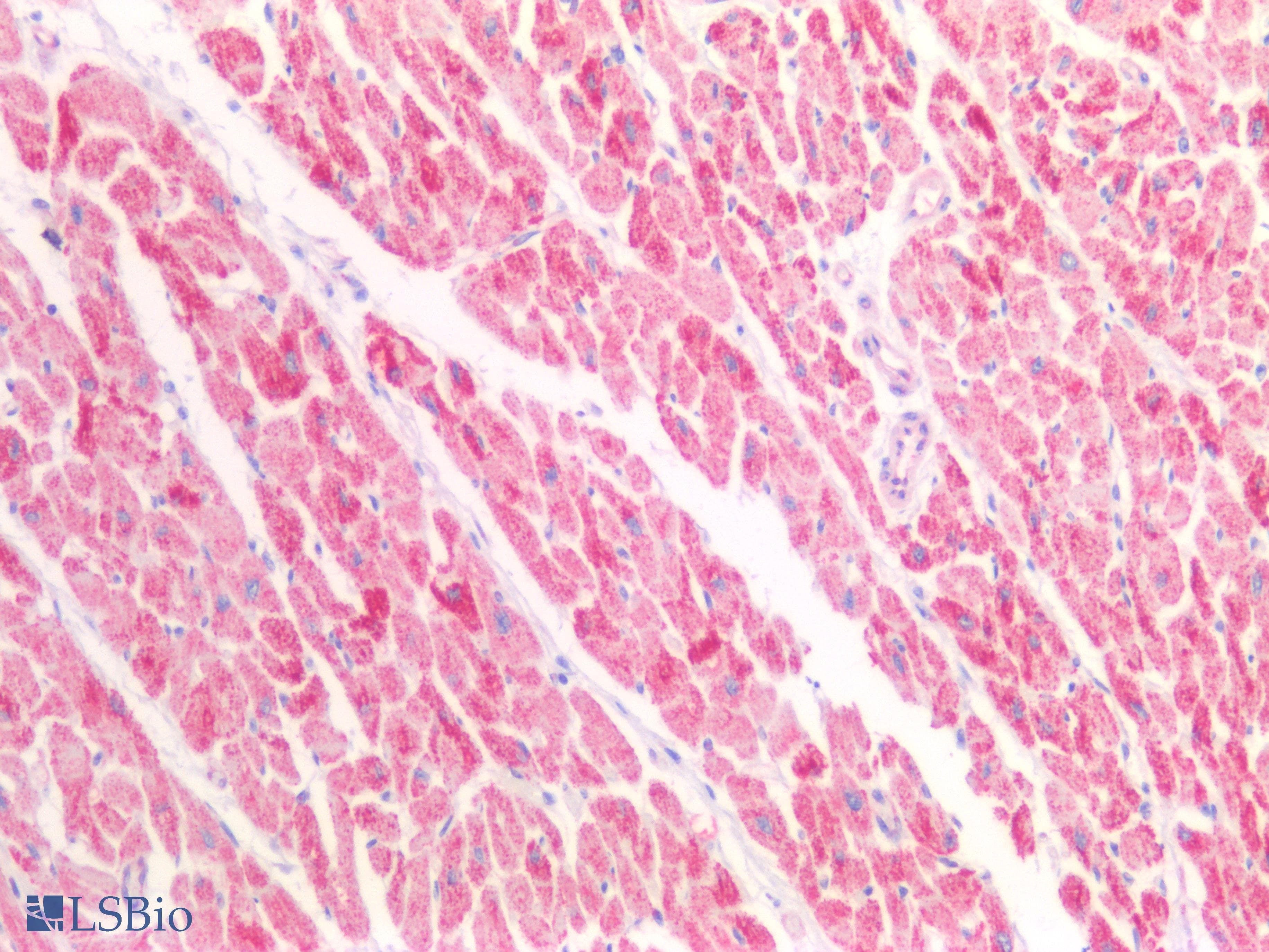PathPlus™ HSD17B12 Antibody