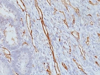 PECAM-1 / CD31 Antibody (clone JC/70A)