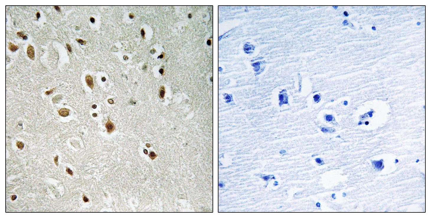 ANKRD20A3 Antibody