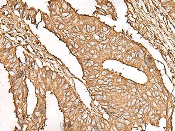 UBE2A Antibody
