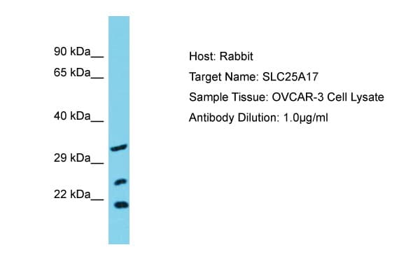 SLC25A17 Antibody (aa63-112)
