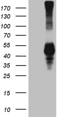 KLRB1 / CD161 Antibody (aa67-225, clone OTI5F10)